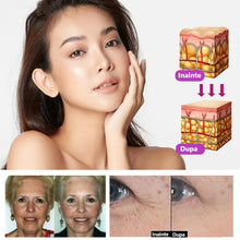 Încarcă imaginea în vizualizatorul Galerie, INNOVA COMPLEX: Set 20 Masti Colagen si Acid Hyaluronic cu Effect Botox